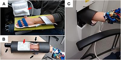 High-Resolution Peripheral Quantitative Computed Tomography for Bone Evaluation in Inflammatory Rheumatic Disease